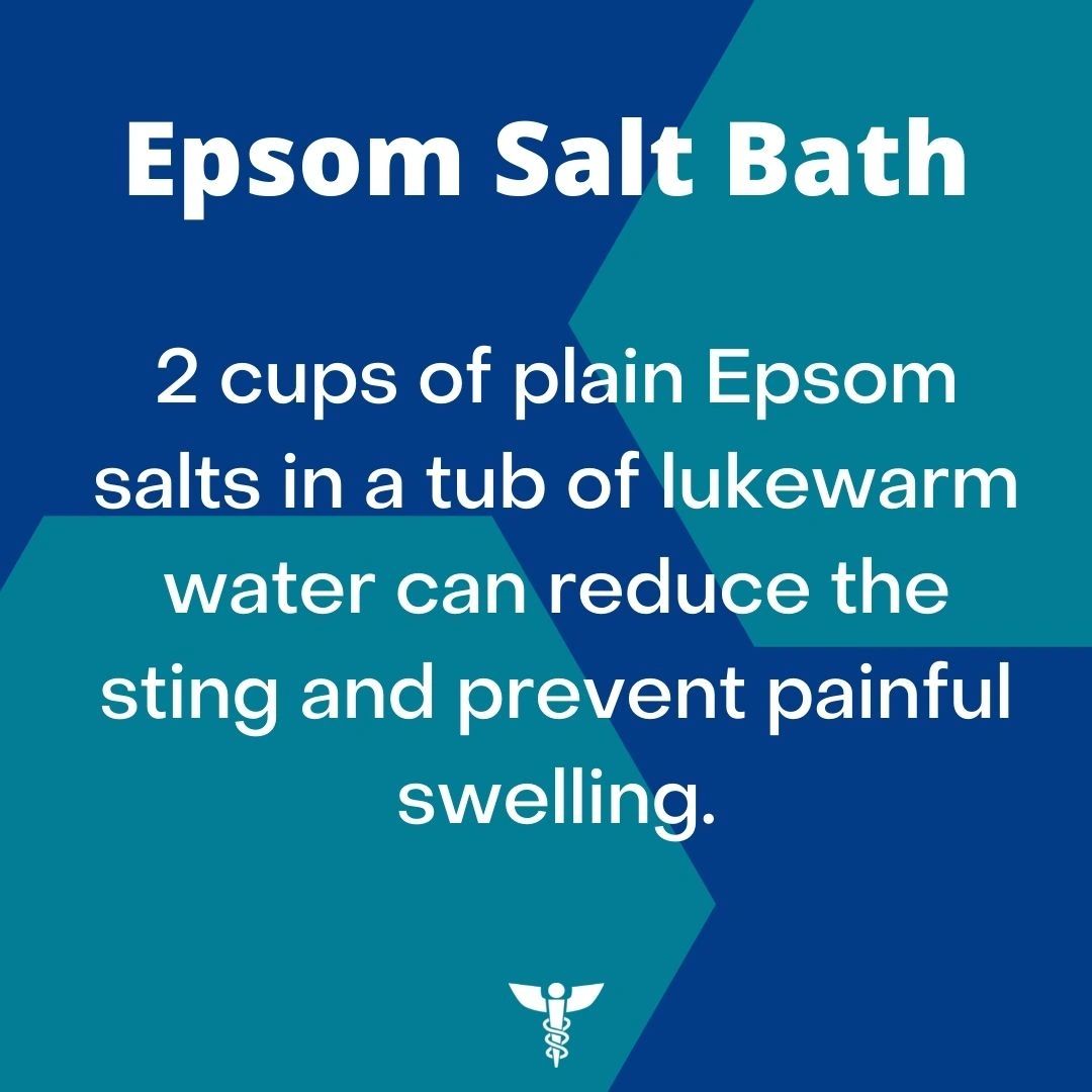 does salt bath help sunburn